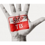 Pharmacies can help fight the TB pandemic